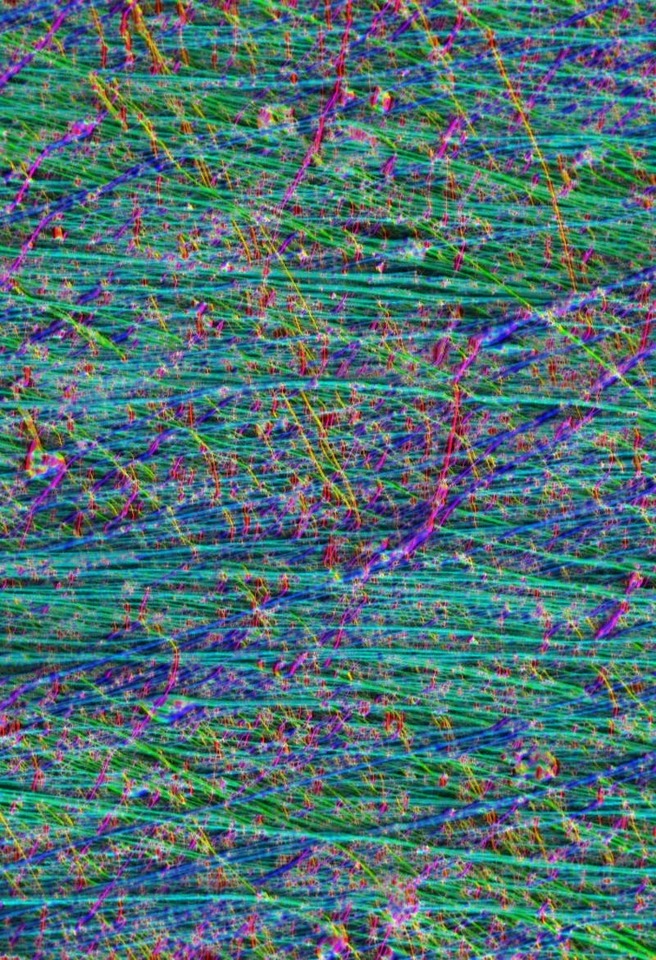Engineering heart valves